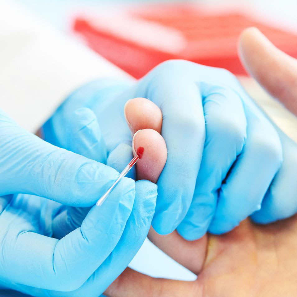 Hormoonbalans hormonale klachten opgeblazen buik na eten EMB boedtest Opgeblazen buik hormonale huidklachten Prikkelbare darm Gezond afvallen orthomoleculair therapeut PCOS Hormonale acne Vetzuren balans Eqology visolie omega 3